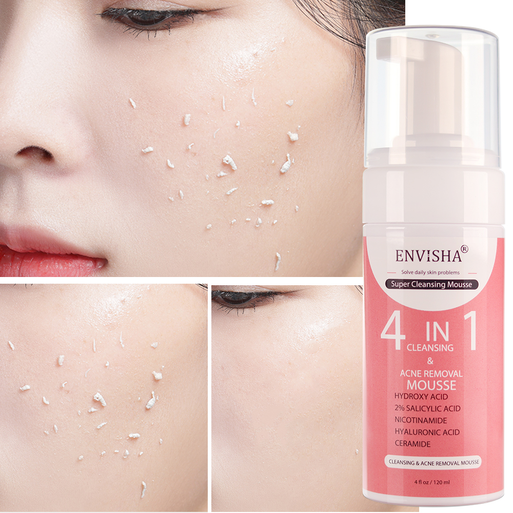 Salicylic Acid Cleanser - ENVISHA Facial Skin Care Exfoliating Mousse