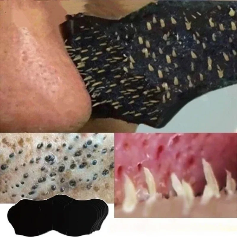 Unisex Blackhead Remove Mask N - đánh giá và giá Skincare Indonesia
