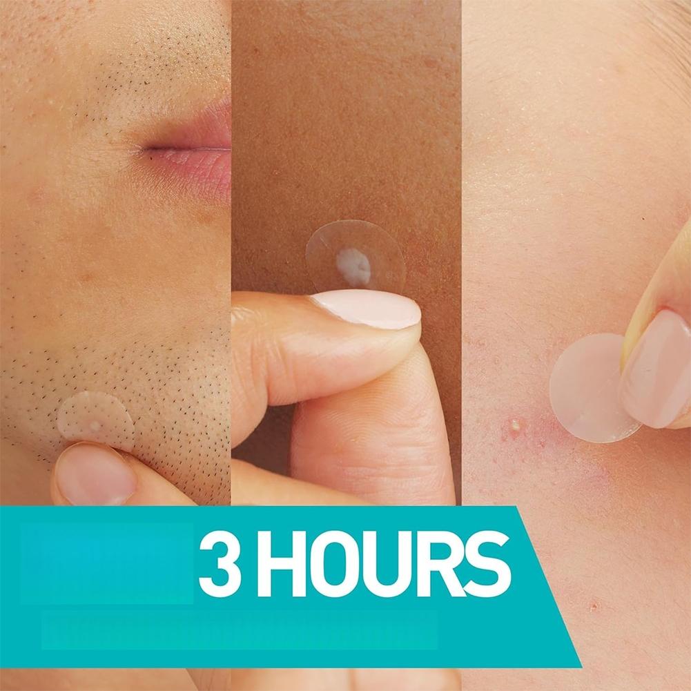 Invisible Pimple Patch 24/200/ - đánh giá và giá Skincare Acne