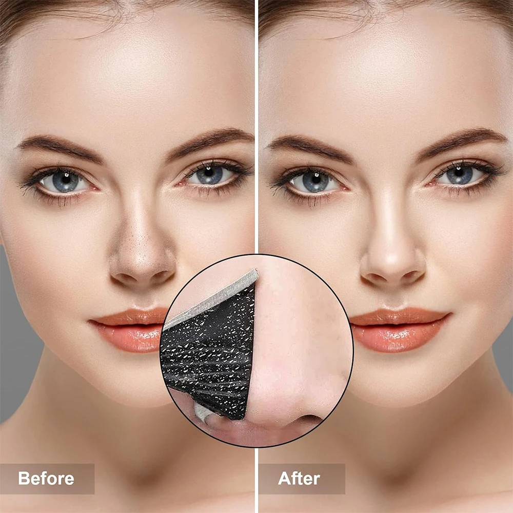 10PCS Unisex Blackhead Remove  - đánh giá và giá Skincare Indonesia