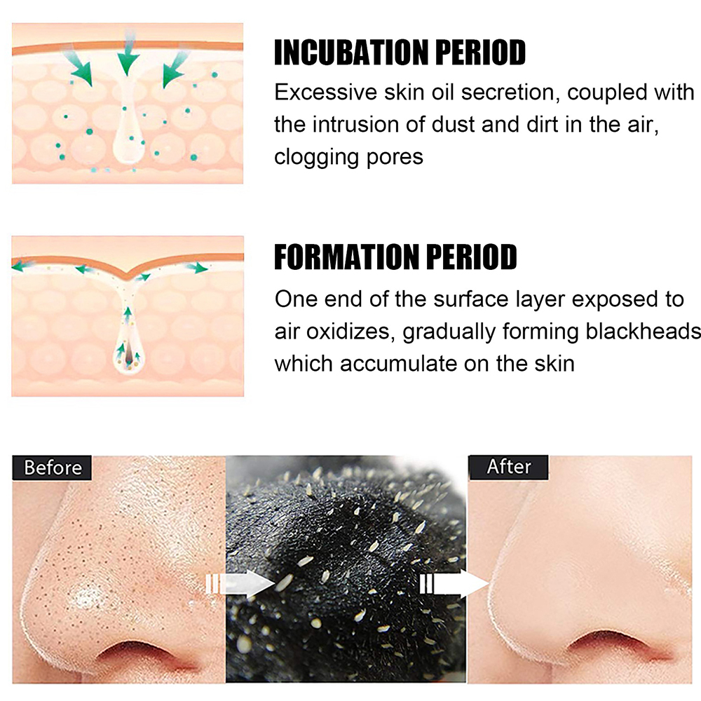 10PCS Unisex Blackhead Remove  - đánh giá và giá Skincare Indonesia