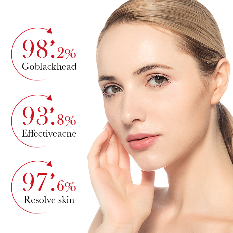 BIOAOUA 1/3/5Pcs Salicylic Aci - đánh giá và giá Salicylic Acid Cleanser