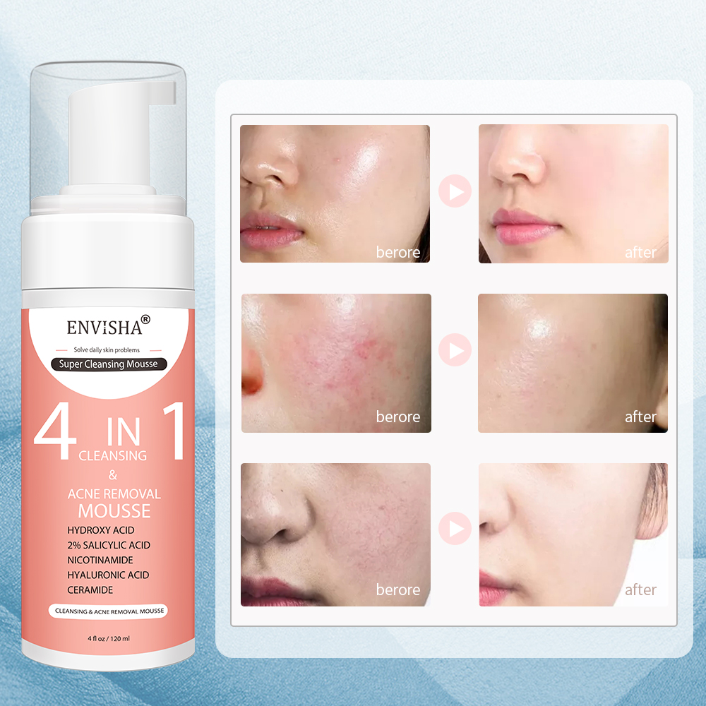 ENVISHA Facial Skin Care Exfol - đánh giá và giá Salicylic Acid Cleanser