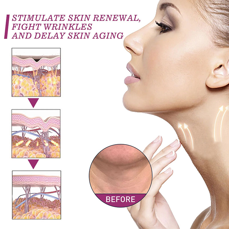 Roller Neck Cream Smooth Wrink - đánh giá và giá Retinol Vitamin A Cream