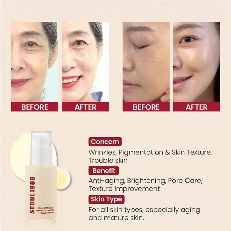 SEOUL 1988 Hydrating Moisturiz - đánh giá và giá Retinol Vitamin A Cream