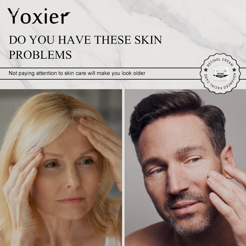Advanced Face Moisturizing Cre - đánh giá và giá Retinol Vitamin A Cream